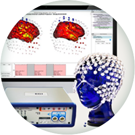 QEEG 검사 이미지